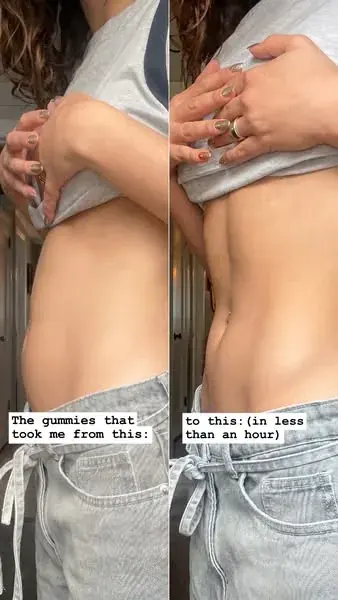 Antes e depois #2