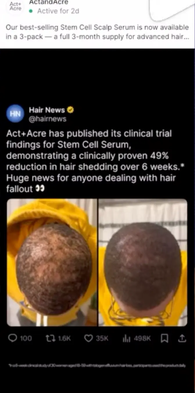 Antes e Depois com Notícia